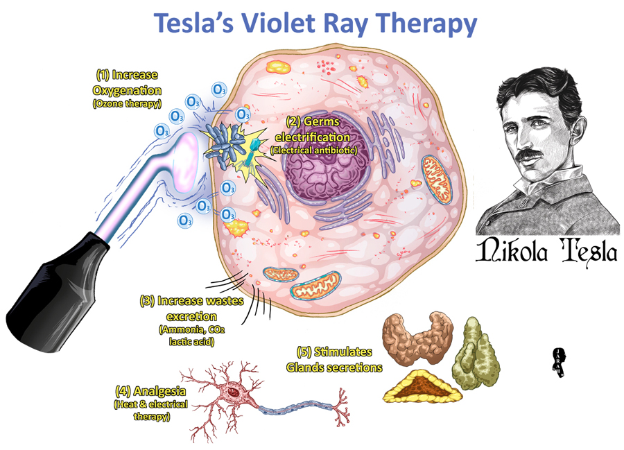 violet ray therapy